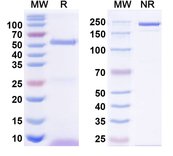 SDS-PAGE for Anti-GABA(A)R, Beta1 Antibody (N96/55)