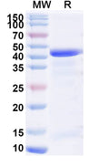 Recombinant Human SIRT6 Protein, N-His