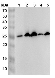 Western blot analysis was performed using anti-SOSTDC1 polyclonal antibody at 1ug/mL on various samples.
Lane 1: Mouse lung lysate
Lane 2: Rat kidney lysate
Lane 3: Rat lung lysate
Lane 4: Rat brain lysate
Lane 5: Rat liver lysate