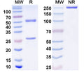 Anti-Human TSLP Reference Antibody (Felcorekibart) – Figure 1 of 1