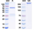 Anti-Human SIGLEC10/SLG2 Reference Antibody (ONC-841) – Figure 1 of 1
