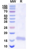 SDS-PAGE for Anti-Human BACE2 Nanobody (SAA0876)