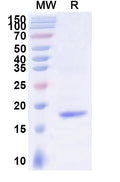SDS-PAGE for Anti-Human BACE2 Nanobody (SAA1007)