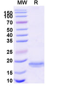 SDS-PAGE for Anti-Human BACE2 Nanobody (SAA1030)