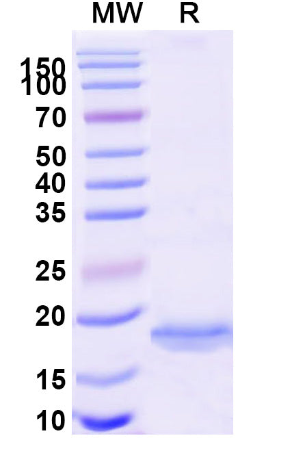 SDS-PAGE for Anti-Human BACE2 Nanobody (SAA1030)