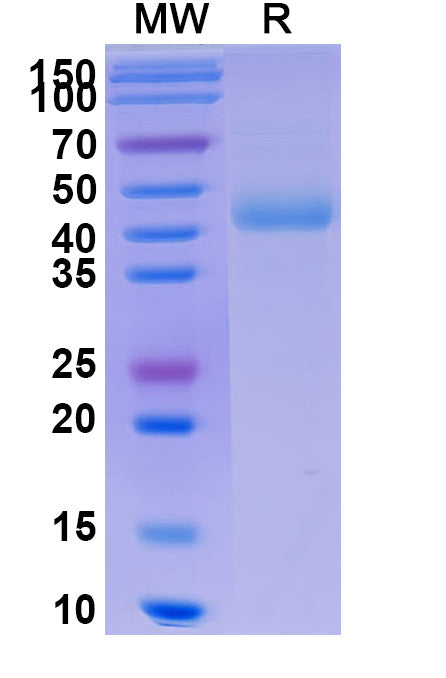 Recombinant Human CD172g/SIRPG Protein, C-His