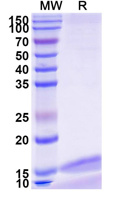 SDS-PAGE for Anti-Human CD217/IL17RA Nanobody (SAA1266)