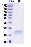 SDS-PAGE for Anti-Human PCSK9 Nanobody (SAA0995)