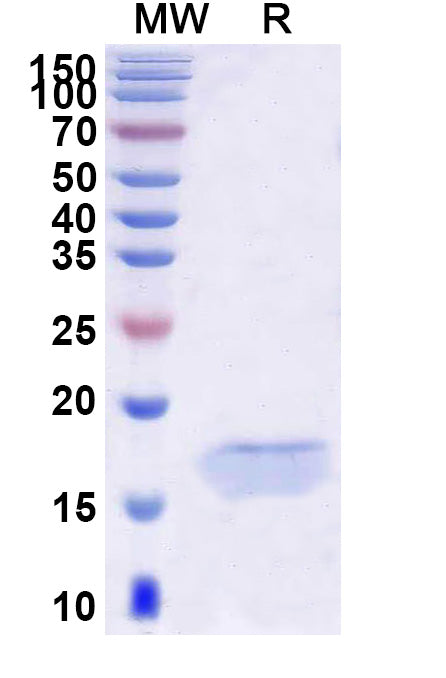 SDS-PAGE for Anti-Human PCSK9 Nanobody (SAA0995)