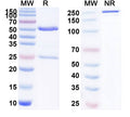 Anti-Human Proprotein Convertase 9/PCSK9 Reference Antibody (Ralpancizumab) – Figure 1 of 1