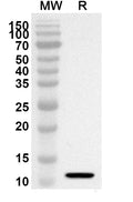 Western blot analysis was performed using anti-RETN polyclonal antibody at 1ug/mL on recombinant RETN (Catalog No. HV285012).