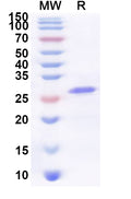 Recombinant Human CD300LG Protein, N-His