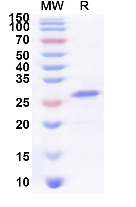 Recombinant Human CD300LG Protein, N-His