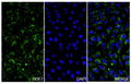 U2OS cells were fixed with 4% paraformaldehyde for 20 minutes, followed by blocking with 5% goat serum for 1 hour. The cells were then incubated with a primary antibody targeting GDF7 (HV295014) at a concentration of 20.75 ug/ml overnight at 4°C. Afterward, the cells were incubated with a secondary antibody, Goat Anti-Rabbit IgG (Alexa Fluor-488) for 50 minutes at room temperature. The localization of GDF7 was visualized (shown in green), and nuclear DNA was stained with DAPI (shown in blue).
