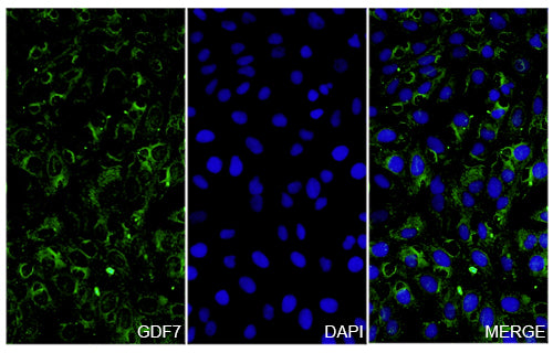 U2OS cells were fixed with 4% paraformaldehyde for 20 minutes, followed by blocking with 5% goat serum for 1 hour. The cells were then incubated with a primary antibody targeting GDF7 (HV295014) at a concentration of 20.75 ug/ml overnight at 4°C. Afterward, the cells were incubated with a secondary antibody, Goat Anti-Rabbit IgG (Alexa Fluor-488) for 50 minutes at room temperature. The localization of GDF7 was visualized (shown in green), and nuclear DNA was stained with DAPI (shown in blue).