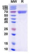 Recombinant Human CD84 Protein, C-Fc