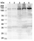 Western blot analysis was performed using anti-DAAM1 polyclonal antibody at 1μg/ml on various samples.
Lane 1: Hela cell lysate
Lane 2: HepG2 cell lysate
Lane 3: Jurkat cell lysate
Lane 4: Mouse liver lysate
Lane 5: Mouse brain lysate
Lane 6: Mouse heart lysate