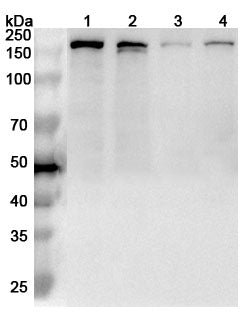 Western blot analysis was performed using anti-RAD50  polyclonal antibody at 1ug/mL  on various samples.
Lane 1: K562 cell lysate
Lane 2: MCF-7 cell lysate
Lane 3: MOLT-4 cell lysate
Lane 4: PC-12 cell lysate