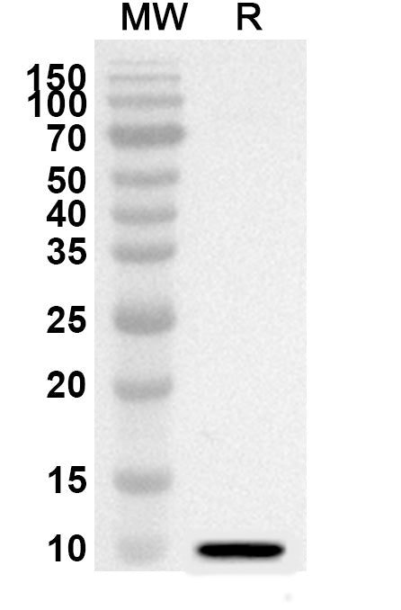Western blot analysis was performed using anti-CD338/ABCG2 polyclonal antibody at 1ug/mL on recombinant CD338/ABCG2 (Catalog No. HV314012).
