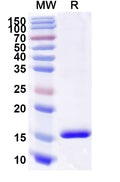 SDS-PAGE for Anti-Human CD89/FCAR1 Nanobody (SAA2151).