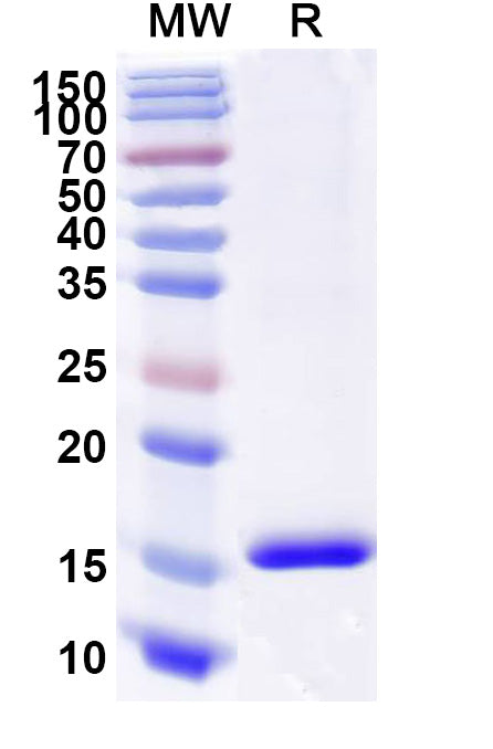 SDS-PAGE for Anti-Human CD89/FCAR1 Nanobody (SAA2151).