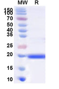 Recombinant Human IL1F10 Protein, N-His