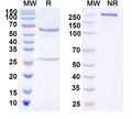 SDS-PAGE for Anti-Human IL38/IL1F10 Antibody (SAA2109)
