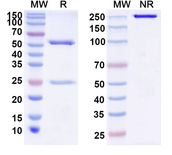 SDS-PAGE for Anti-Human IL38/IL1F10 Antibody (IMM20130)