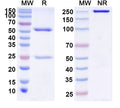 SDS-PAGE for Anti-Human IL38/IL1F10 Antibody (M3)