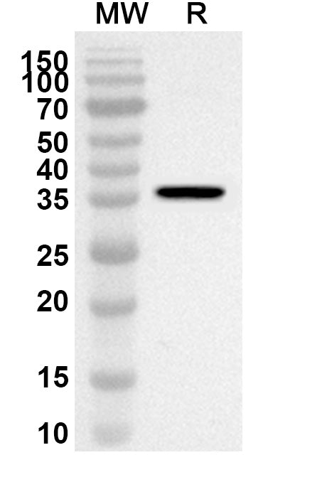Western blot analysis was performed using anti-PLSCR4 polyclonal antibody at 1ug/mL on recombinant PLSCR4 (Catalog No. HV339012).