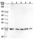 Western blot analysis was performed using anti-NAXE polyclonal antibody at 1ug/mL on various samples.
Lane 1: Mouse kidney lysate
Lane 2: Rat liver lysate
Lane 3: Rat kidney lysate
Lane 4: Rat heart lysate
Lane 5: Rat testis lysate