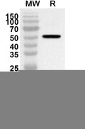 Western blot analysis was performed using anti-CD93 polyclonal antibody at 1ug/mL on recombinant CD93 (Catalog No. HV345012).