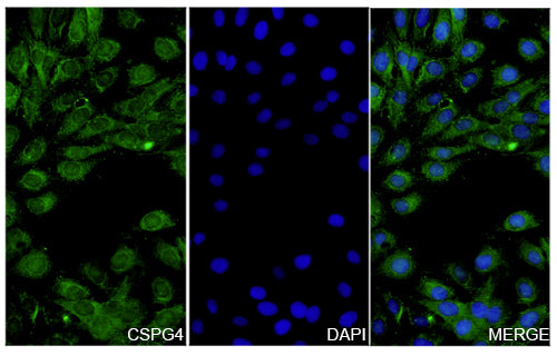 U2OS cells were fixed with 4% paraformaldehyde for 20 minutes, followed by blocking with 5% goat serum for 1 hour. The cells were then incubated with a primary antibody targeting CSPG4 (HV349014) at a concentration of 28 ug/ml overnight at 4°C. Afterward, the cells were incubated with a secondary antibody, Goat Anti-Rabbit IgG (Alexa Fluor-488) for 50 minutes at room temperature. The localization of CSPG4 was visualized (shown in green), and nuclear DNA was stained with DAPI (shown in blue).