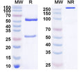 SDS-PAGE for Anti-Human MDA5/IFIH1 Antibody (SAA2091).