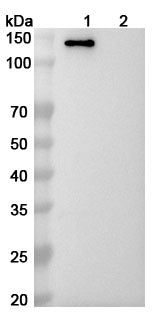 Western blot analysis was performed using anti-MDA5 monoclonal antibody at 1ug/mL on various samples.
Lane 1: recombinant human MDA5  (Catalog No: HV365021)
Lane 2: negative control