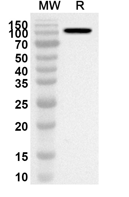 Western blot analysis was performed using anti-Human MDA5/IFIH1 polyclonal antibody at 1ug/mL on recombinant Human MDA5/IFIH1 (Catalog No. HV365032).