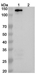 Western blot analysis was performed using anti-MDA5 monoclonal antibody at 1ug/mL on various samples.
Lane 1: recombinant human MDA5  (Catalog No: HV365021)
Lane 2: negative control