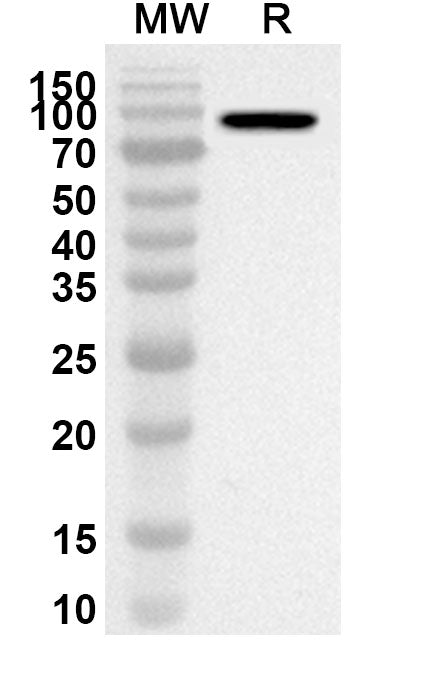 Western blot analysis was performed using anti-Human MDA5/IFIH1 polyclonal antibody at 1ug/mL on recombinant Human MDA5/IFIH1 (Catalog No. HV365052).