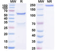 SDS-PAGE for Anti-Human CD229/LY9 Antibody (SAA1619)