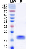 SDS-PAGE for Anti-Human ADAMTS5 Nanobody (SAA1219)