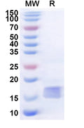 Recombinant Human BTLA Protein, N-His