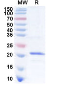 Recombinant Human CD300A Protein, N-His