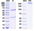 SDS-PAGE for Anti-Human ANGPTL8 Antibody (SAA1698)