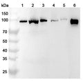 Western blot analysis was performed using anti-PDCD6IP polyclonal antibody at 1ug/mL on various samples.
Lane 1: NIH3T3 cell lysate
Lane 2: Jurkat cell lysate
Lane 3: K562 cell lysate
Lane 4: PC-12 cell lysate
Lane 5: Mouse liver lysate
Lane 6: Rat liver lysate
