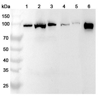 Western blot analysis was performed using anti-PDCD6IP polyclonal antibody at 1ug/mL on various samples.
Lane 1: NIH3T3 cell lysate
Lane 2: Jurkat cell lysate
Lane 3: K562 cell lysate
Lane 4: PC-12 cell lysate
Lane 5: Mouse liver lysate
Lane 6: Rat liver lysate