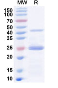 Recombinant Human PDCD6IP Protein, N-His