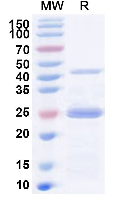 Recombinant Human PDCD6IP Protein, N-His