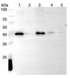Western blot analysis was performed using anti-IL36A polyclonal antibody at 1μg/ml on various samples.
Lane 1: MDA-MB-231 cell lysate
Lane 2: MCF7 cell lysate
Lane 3: Mouse lung lysate
Lane 4: Rat brian lysate
Lane 5: Rat lung lysate