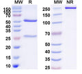 Anti-Human Nectin-2/CD112 Reference Antibody (Remzistotug) – Figure 1 of 1