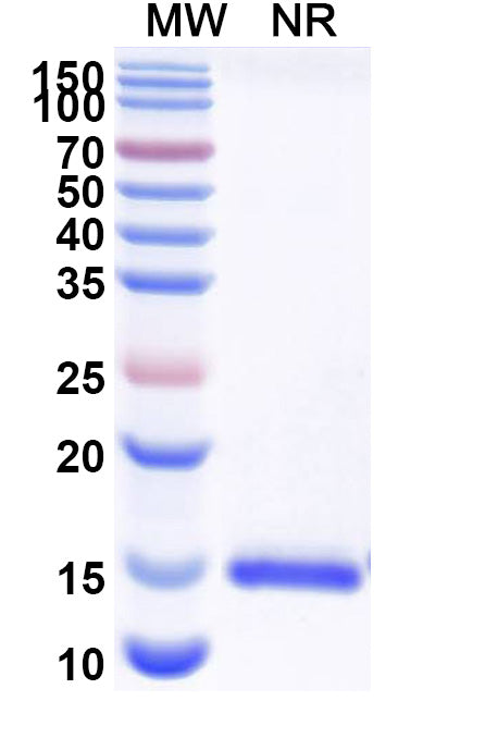 SDS-PAGE for Anti-Human CD112/Nectin-2/PVRL2 Nanobody (SAA2116).